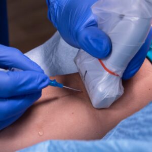 Envision Ultrasound Probe Covers